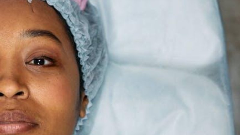 Dermal Fillers for Natural Facial Volume Enhancement